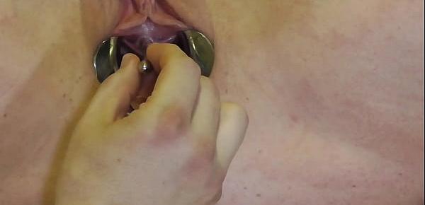  Analslut Filled with her own piss in speculum gaping pussy.  Urethra stretched with sounds - biggest yet, 10mm